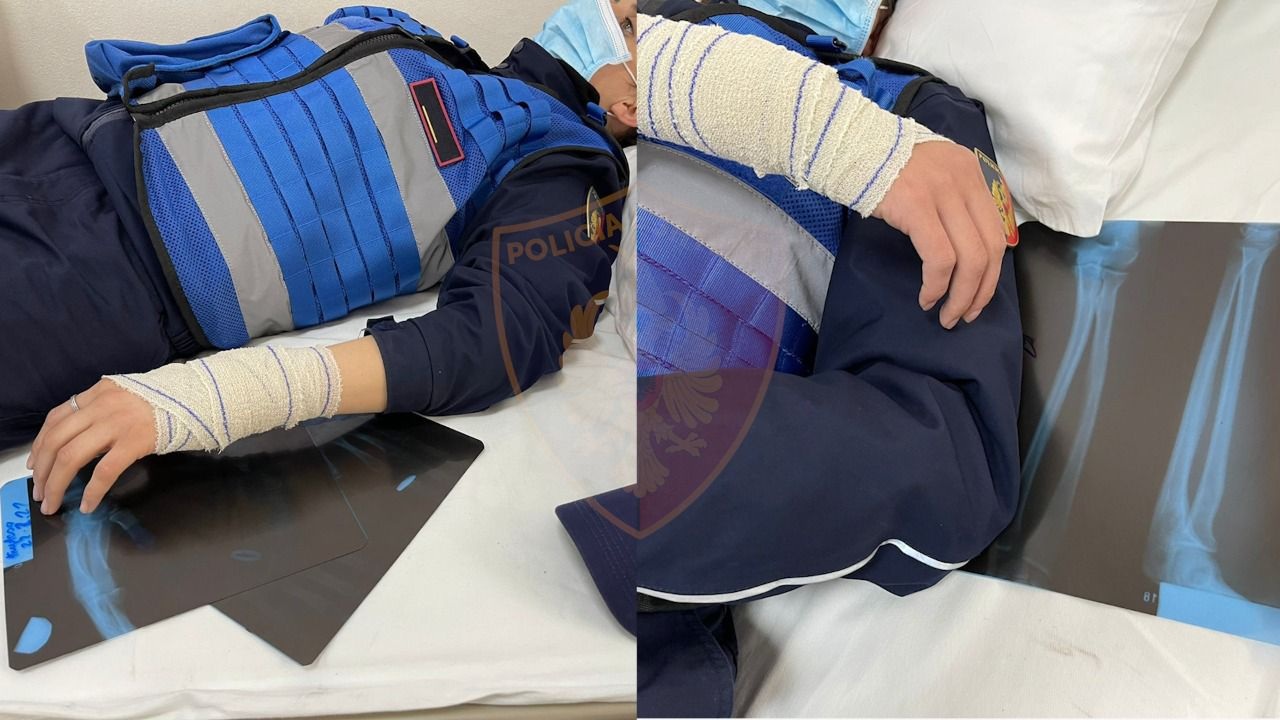 Rezistenca e banorëve të “5 Majit”, plagosen tetë punonjës të policisë, shoqërohen disa persona