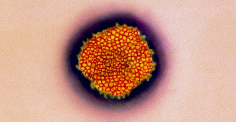 Infektohen dy persona me virusin “Lassa” në Angli, i ngjashëm me Ebolën