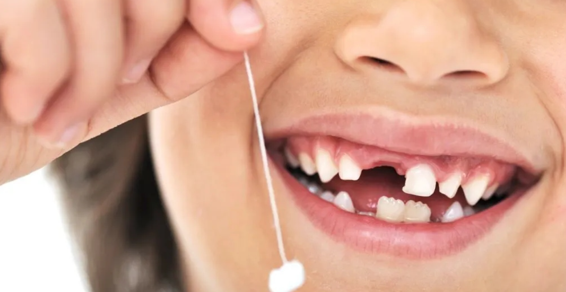 Mos ia hidhni kurrë “dhëmbët e qumështit” fëmijëve, mund t’u shpëtojnë jetën më vonë