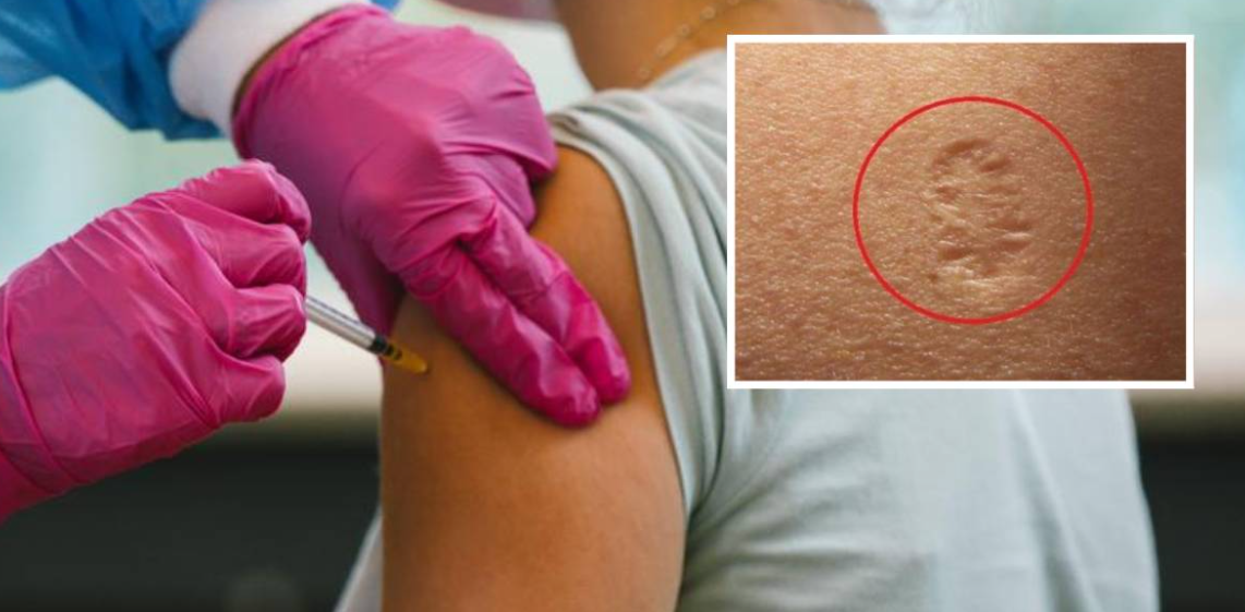 E keni parë shpesh dhe ju konfuzon? Ja cili është kuptimi i kësaj shenje në krah