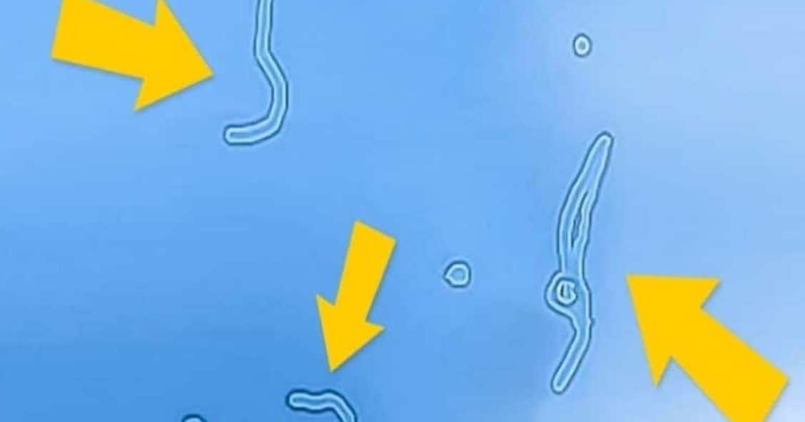 A e dini pse ju bëjnë sytë xixa ndonjëherë? Është momenti ta mësoni se ç’ndodh