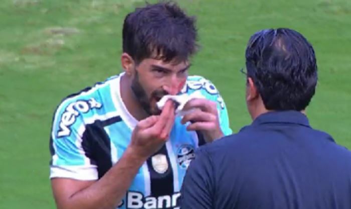 Pamje shokuese nga Brazili, futbollisti i Gremios gjakoset nga një … telefon