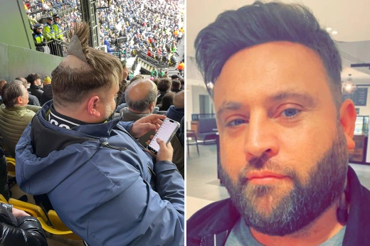 Tifozit të Arsenal i shkëputet parukja duke festuar golin në stadium: Duhet të përdor më shumë ngjitëse