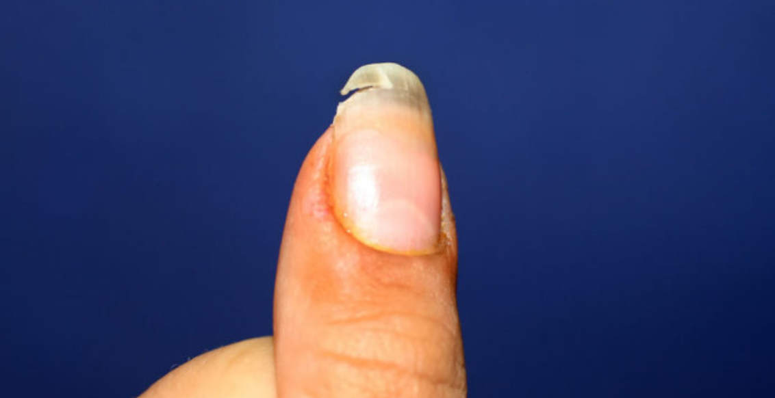 Rregulloni thoin e thyer me këtë hile në shtëpi