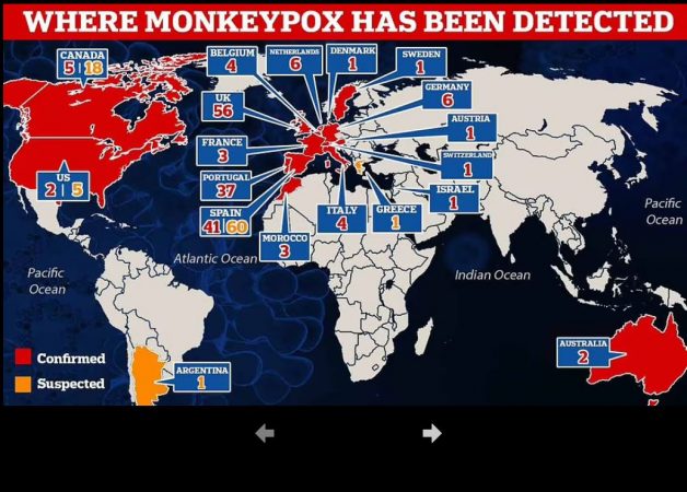 Virologët ngrenë alarmin: Lija e majmunëve është bërë më ngjitëse