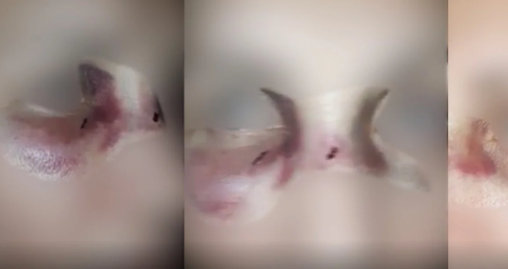 20 vjet dhunë sistematike nga bashkëshorti, nëna e 3 fëmijëve rrëqeth me rrëfimin