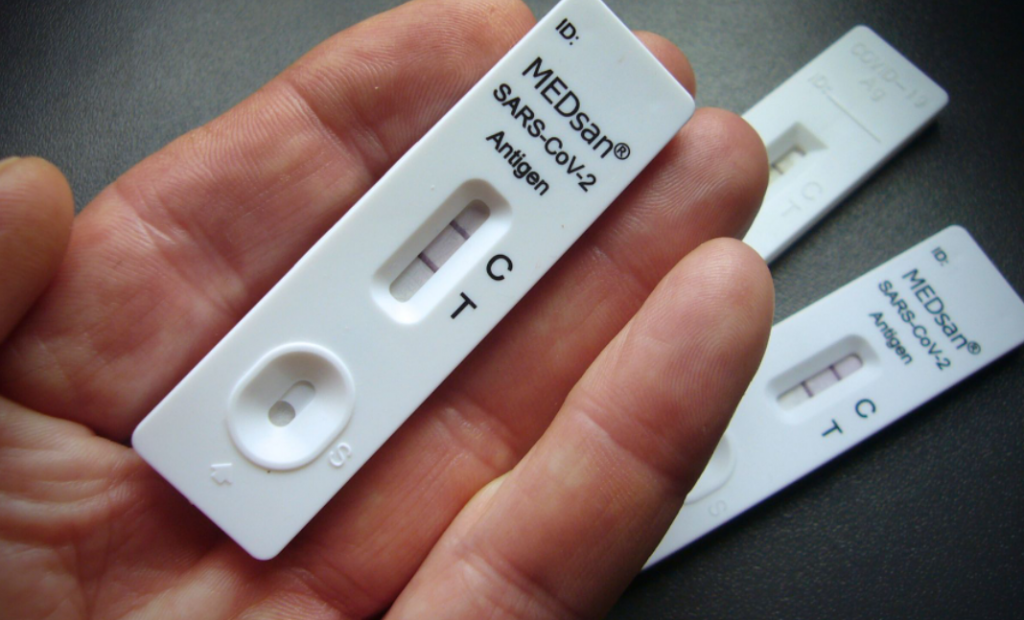 Studimi britanik zbulon se rastet e rënda të Covid-it shkaktojnë dëmtime të kujtesës