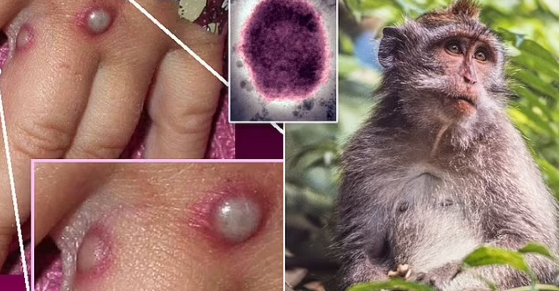 Sëmundja afrikane godet Europën/ Anglia, Spanja dhe Portugalia në alarm