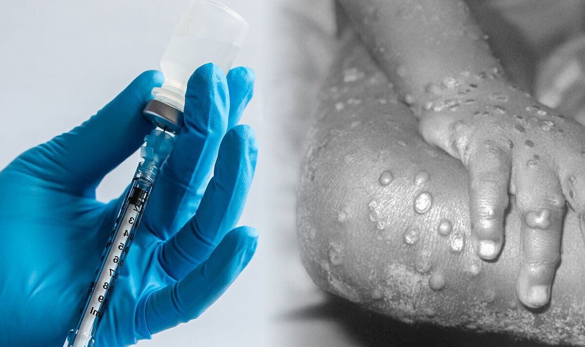 Gjermania porosit vaksinën kundër lisë së majmunëve