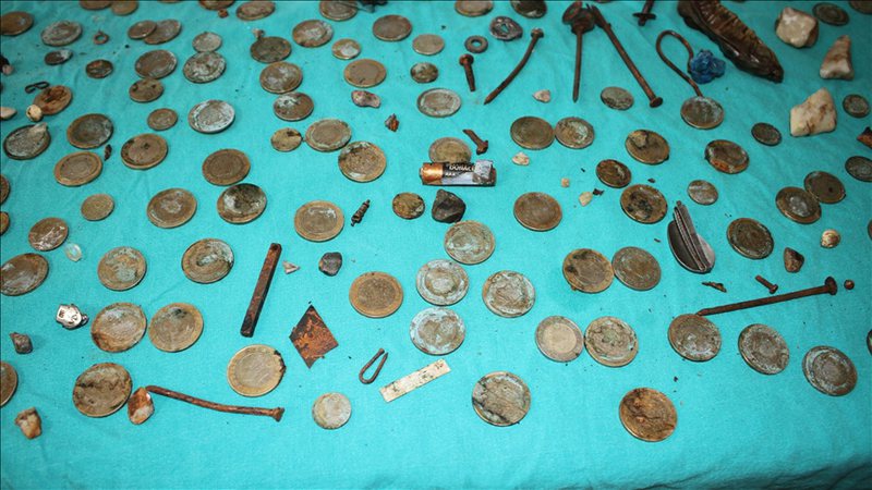 35-vjeçari shkon me dhimbje të forta në spital, mjekët nuk i besojnë syve kur shohin çfarë ka brenda stomakut të tij