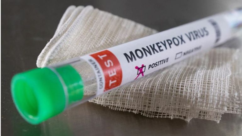 Lija e majmunëve, OBSH konfirmon 780 raste në 27 vende