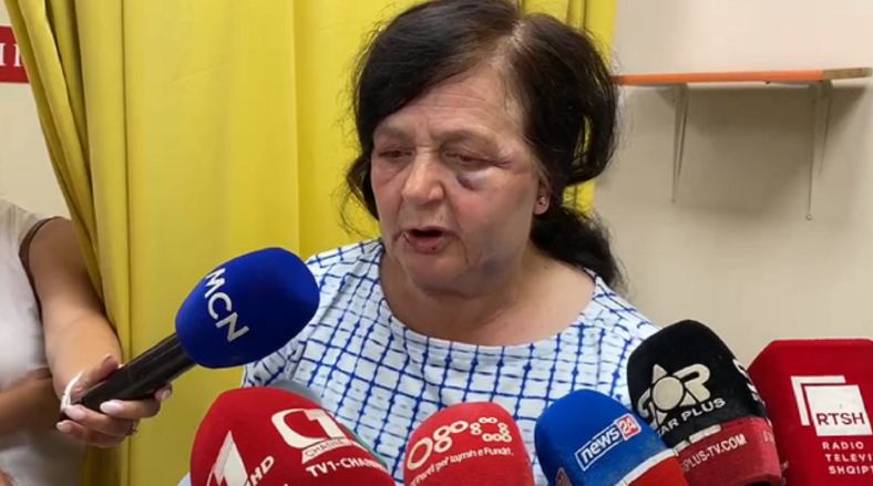 Flet gruaja e dhunuar në Vermosh: Autorët më goditën me levë kokës, ishin të maskuar por me dialektin tonë