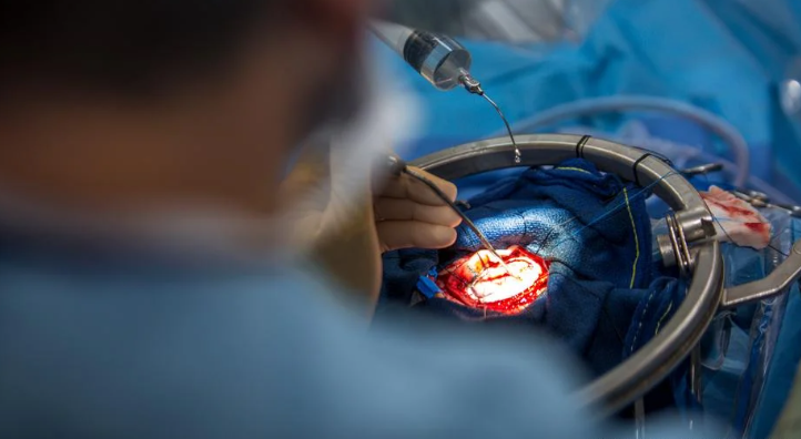 Një dritë shprese për pacientët me kancer