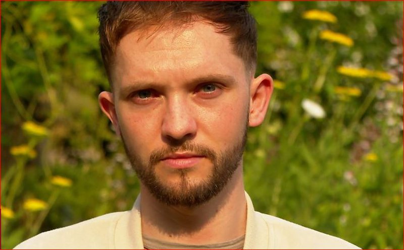 U infektua me linë e majmunit, flet i riu: Puçrrat u përhapën në organet gjenitale, nuk e mendoja kurrë se do &#8230;