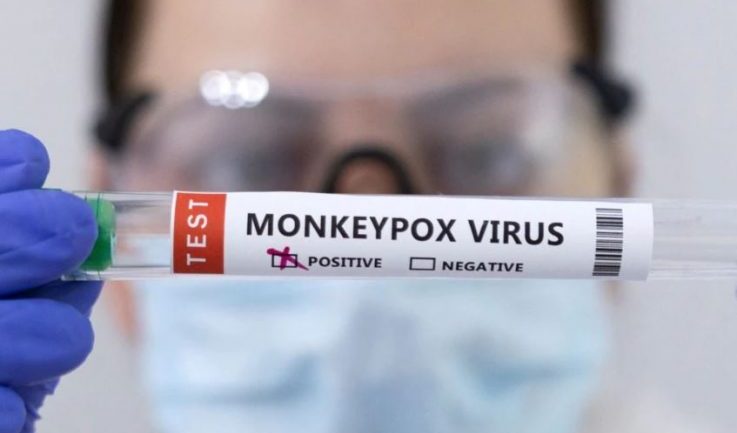 Emergjencë globale nga OBSH, BE miraton vaksinën kundër lisë së majmunit