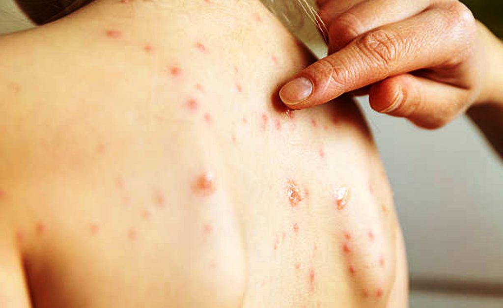 Zbulohet rasti i parë i lisë së majmunit në Malin e Zi