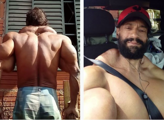 Vdes “Hulku brazilian” që injektonte vaj në muskuj