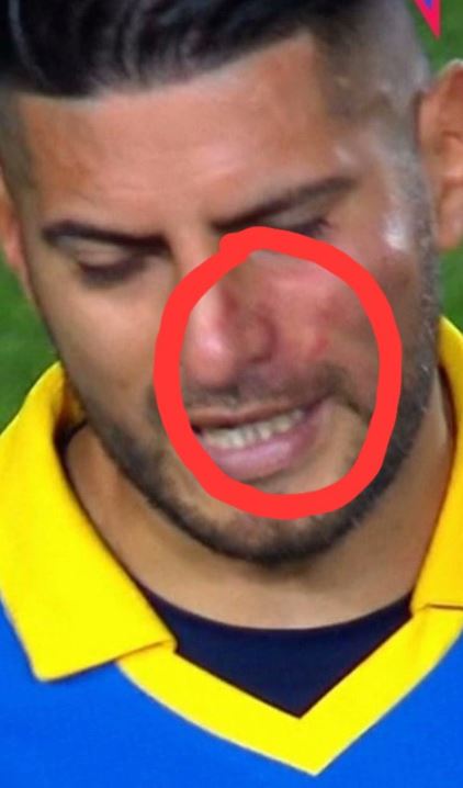 Sherr te skuadra e njohur, lojtari godet me grushte shokun e ekipit