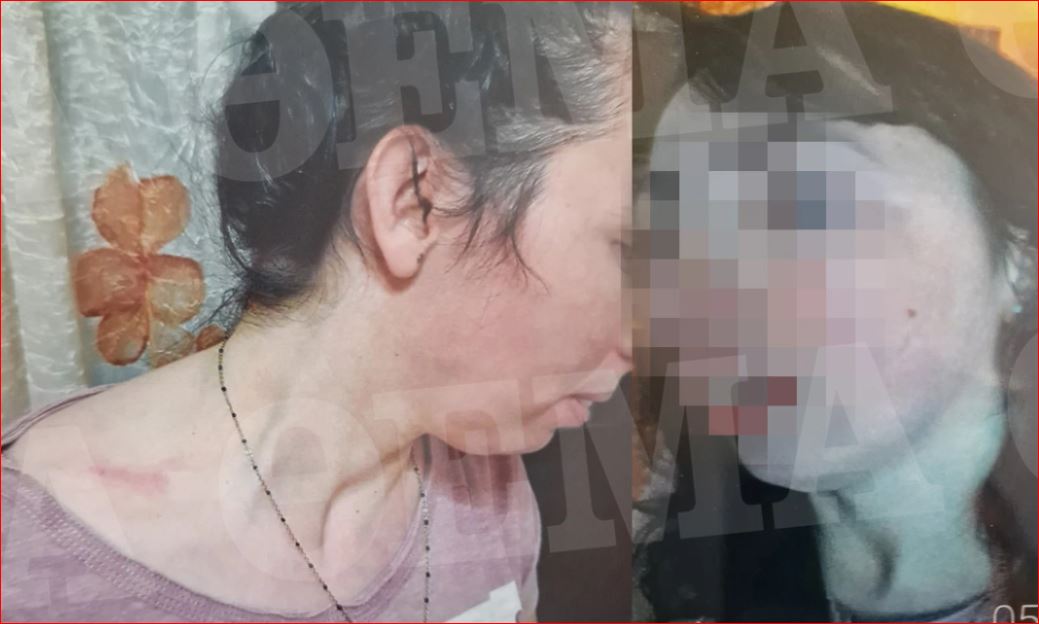 Tjetër rast dhune në familjet shqiptare në Greqi, 38-vjeçari masakron gruan në sy të fëmijëve, djali 6 vjeç e shpëton