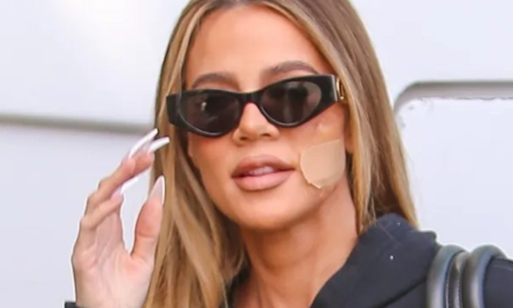 Khloe Kardashian heq një tumor të rrallë nga fytyra, ka një apel për të gjithë