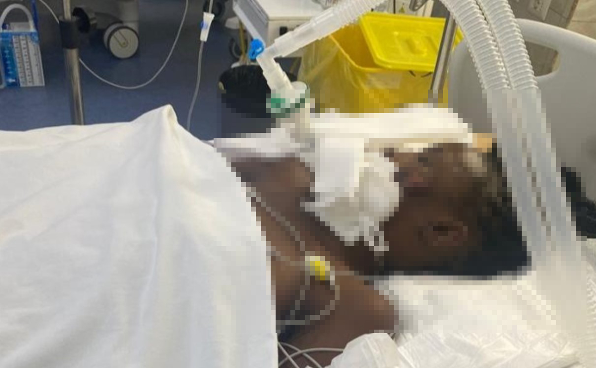 E rëndë! 22-vjeçarja keniane “dhunohet barbarisht”, gjendet me trauma në tru dhe brinjë të thyera pas pallatit në Tiranë