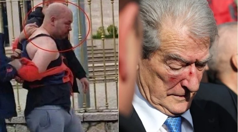 Goditi me grusht Sali Berishën, ‘arrest me burg’ për 31-vjeçarin Gert Shehu