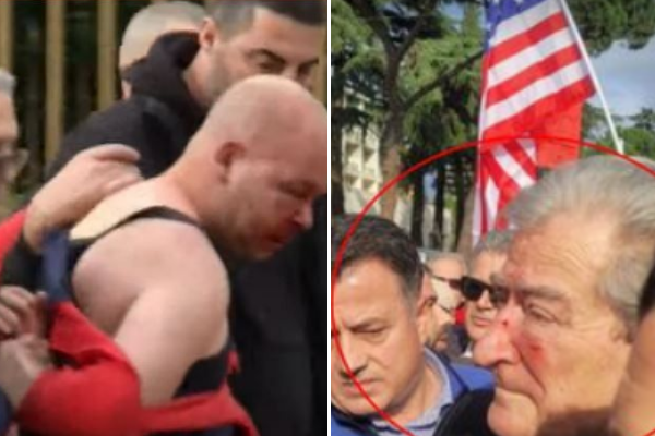 Sulmi ndaj Berishës, reagon Komiteti Shqiptar i Helsinkit