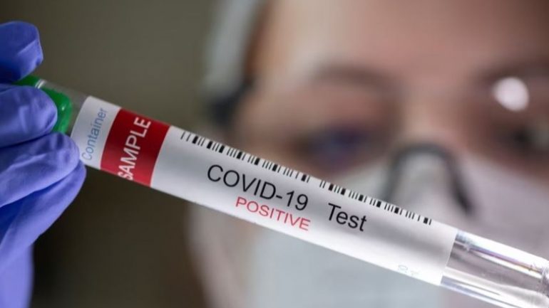 Studimet amerikane e britanike: Vaksinat mbrojnë kundër COVID-it afatgjatë