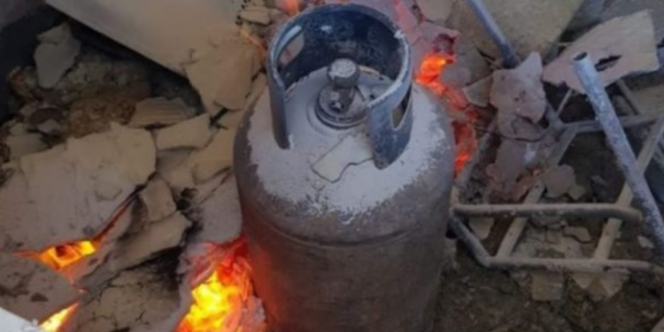 Shpërthen bombola e gazit, plagoset 40-vjeçari, përfundon në spital me djegie trupore