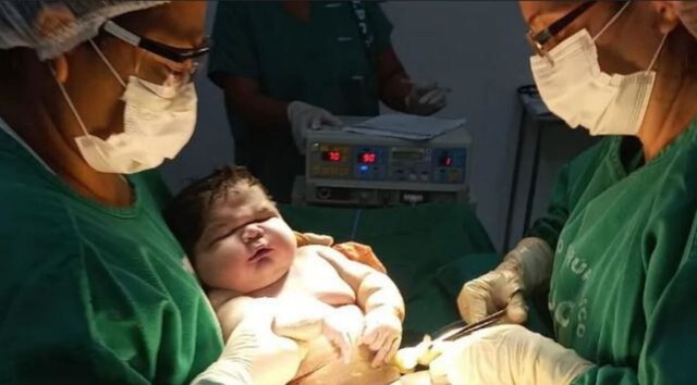 Lind foshnja 7.3 kg në Brazil, shokohen mjekët