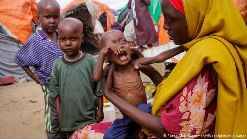 Kriza më e madhe ushqimore në botë që nga Lufta e II Botërore