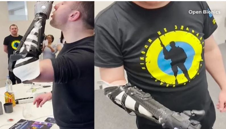 Humbën gjymtyrët në luftë, ushtarët ukrainas marrin protezat bionike