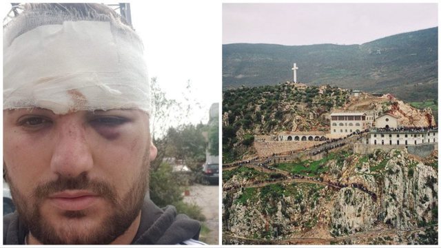 Me syrin e nxirë dhe mavijosje në trup, dalin fotot e rojës së kishës së Laçit që u dhunua nga tregtarët