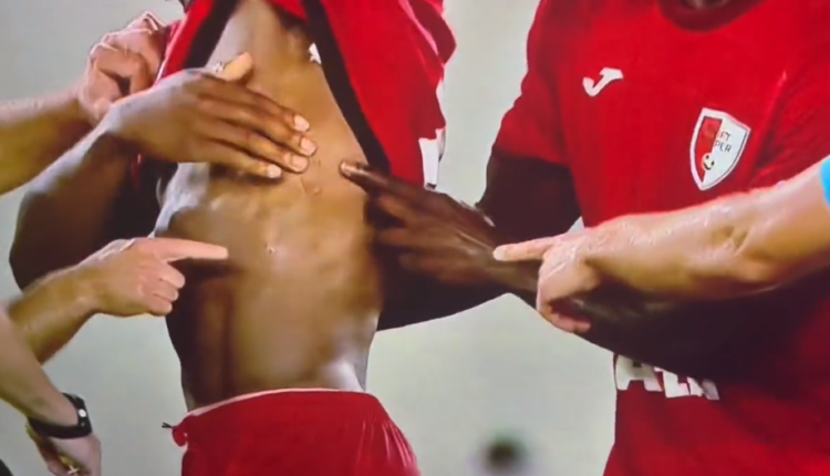 E pazakontë/ Ish-futbollisti i Milanit kafshon kundërshtarin gjatë ndeshjes