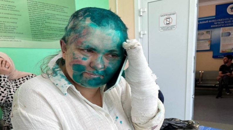 Gazetarja dhe avokati i njohur rus kërcënohen dhe dhunohen brutalisht në Çeçeni! Pamjet e rënda bëjnë xhiron e rrjetit