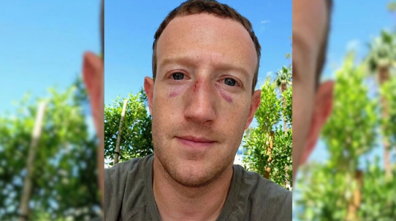 Habit Mark Zuckerberg, publikon foto me sytë e nxirë dhe hundën e gjakosur