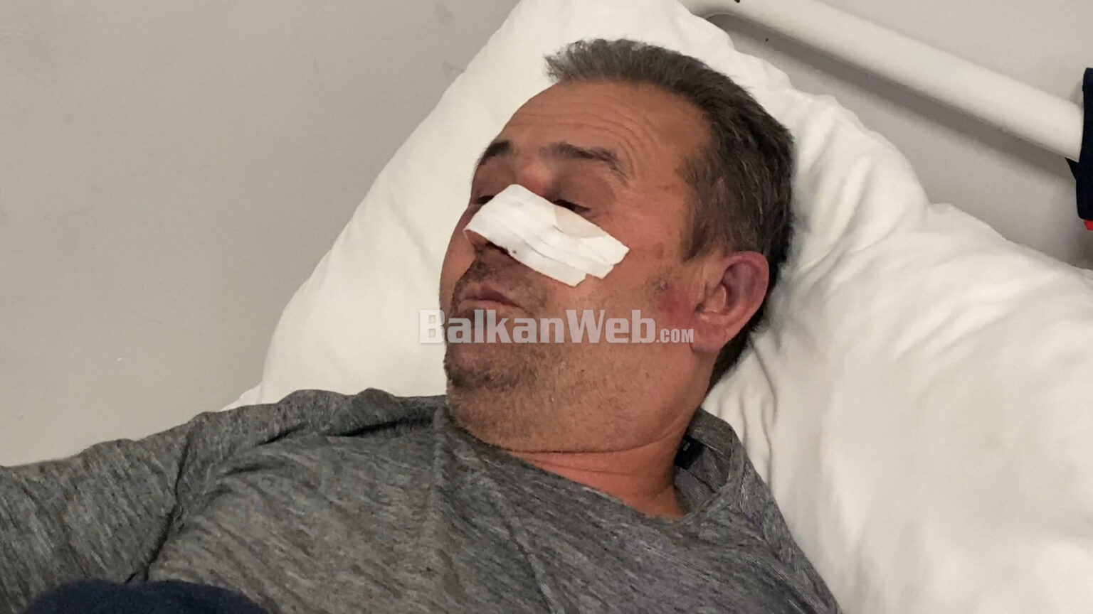 U bë për spital nga hajdutët e armatosur, 54-vjeçari rrëfen momentin e tmerrit: Më goditën me tytën e armës në kokë dhe…