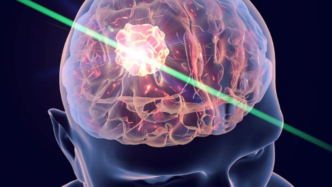 Zhvillohet testi i parë i gjakut në botë për tumorin në tru, rrit shanset për mbijetesë