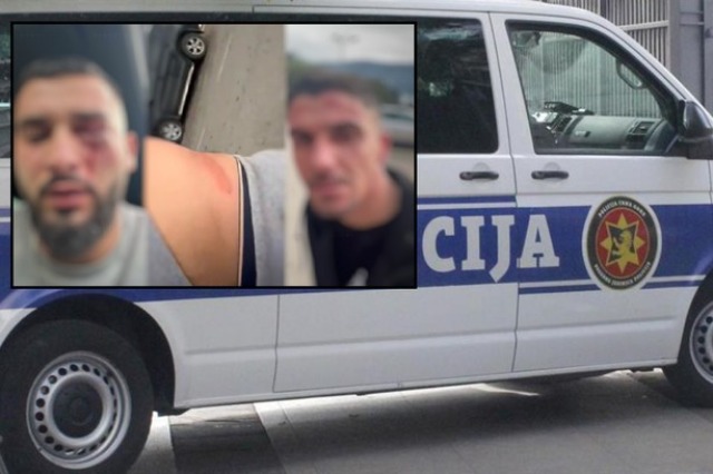 “Kishim flamurin shqiptar në pasqyrën e automjetit”, zbardhet dëshmia e njërit prej personave të dhunuar në Malin e Zi