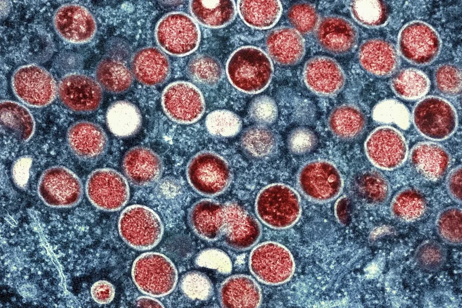 Zbulohet një virus i ri vdekjeprurës, çfarë paralajmëron OBSH?