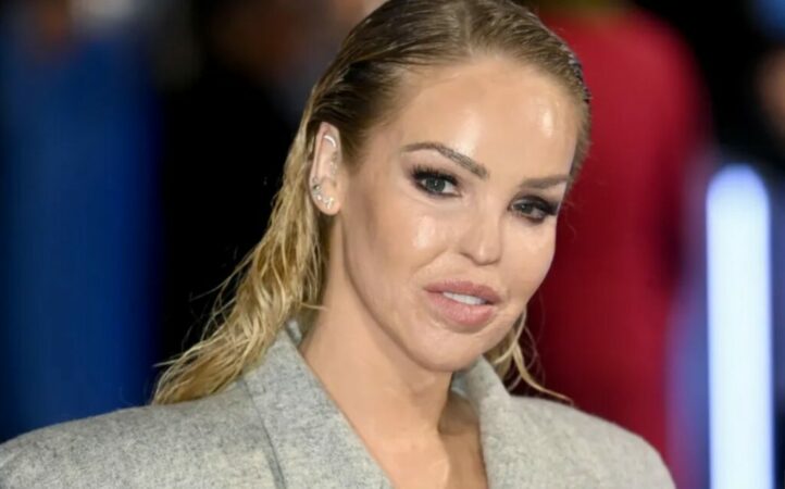 16 vite pas sulmit me acid, Katie Piper bën ndryshimin në pamjen e saj