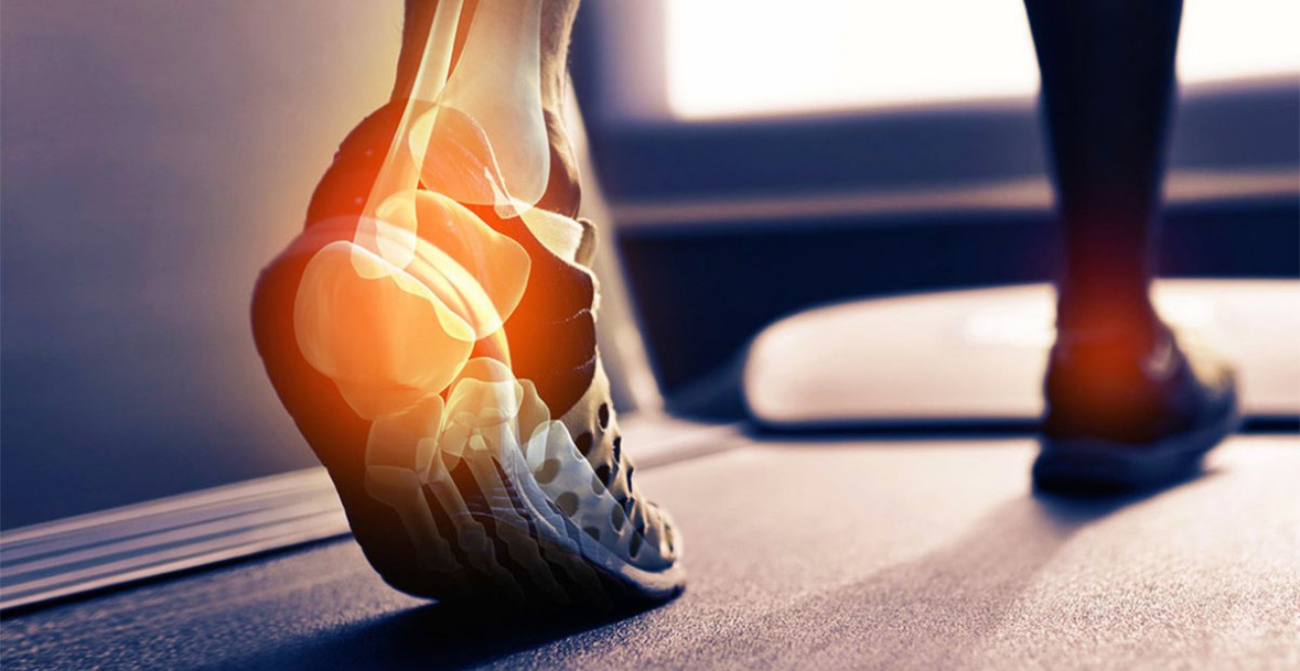 Dhimbja e kockave: Si një orë ecje në javë mund të lëmirësojë Osteoartritin