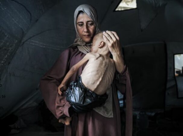 Katastrofë humanitare/ Qindra të vdekur nga kequshqyerja në Gaza, shumica prej tyre fëmijë!