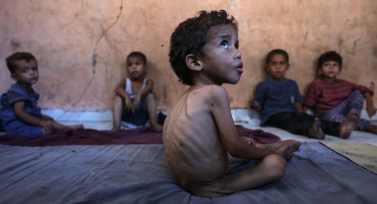 OKB: Pothuajse një e treta e banorëve të Gazës nuk po hanë për ditë të tëra