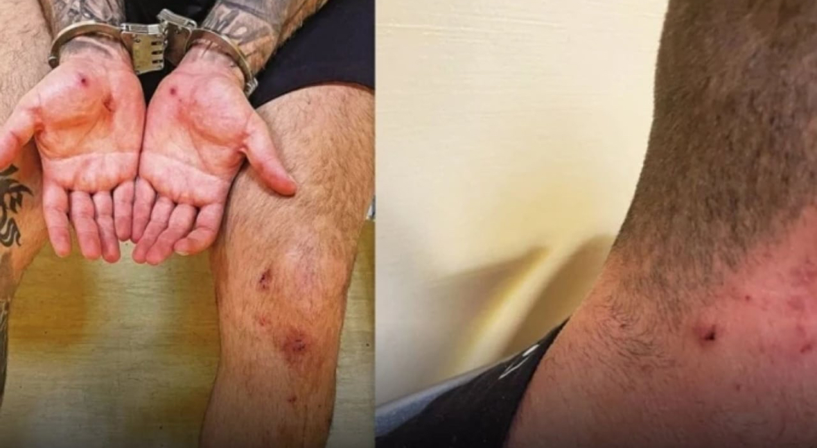 “Do të të pëlqejë”/ 19-vjeçarja denoncon dy persona se tentuan ta përdhunonin në tualetin e klubit të natës, i përfshirë edhe boksieri i njohur shqiptar