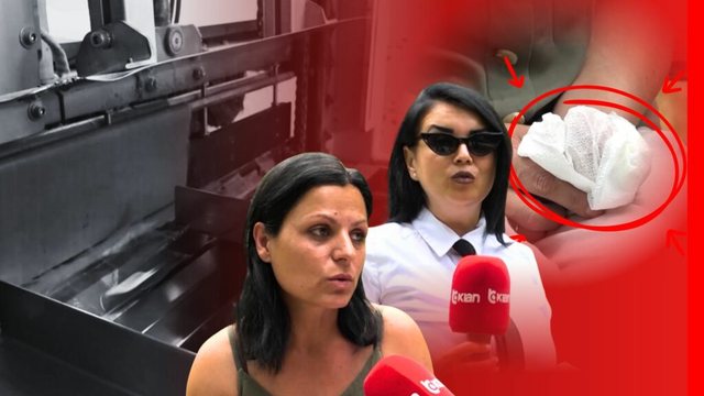 “Bëja edhe punën e mekanikut”, punonjësja humb gishtat në fabrikën e letrës në Korçë