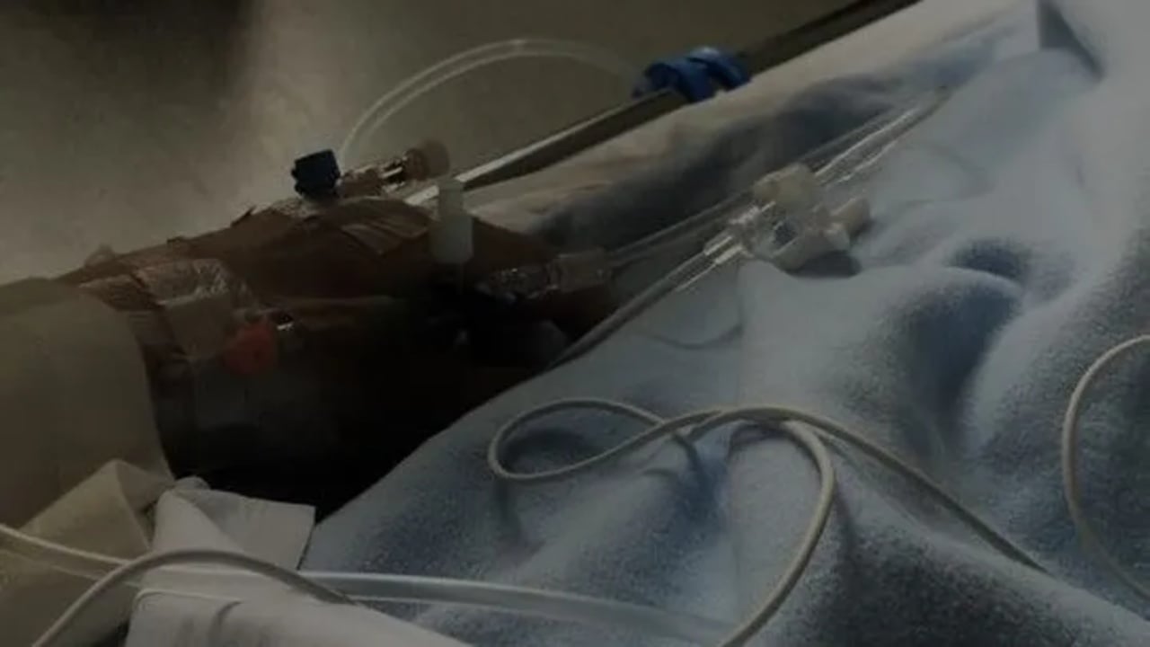 U plagos në atentat, familjarët e kamerieres 25-vjeçare apel për ndihmë për kurimin e saj