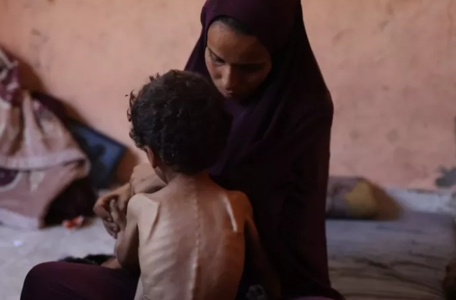 13 persona humbën jetën nga uria në Gaza 24 orët e fundit, mes tyre 3 të mitur