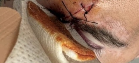 Turisti u sulmua dhe u grabit nga pesë persona në Durrës! Reagon Policia: Për rastin janë ndaluar dy minorenë