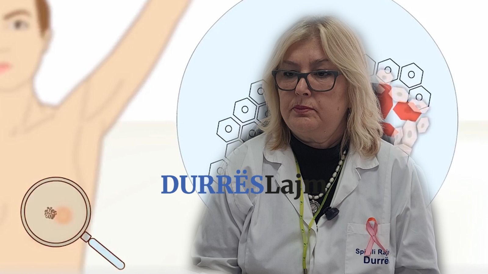Onkologia Zoto: Në Durrës kemi 80-100 raste të reja çdo vit me kancer gjiri (VIDEO)